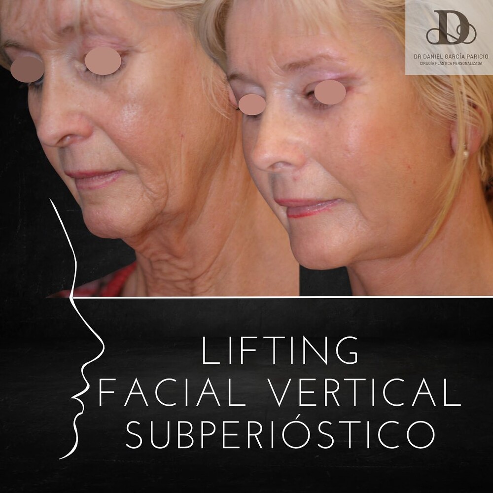 Clinic Results Gallery